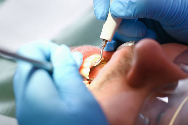 Best Emergency Cosmetic Dentistry in Garrison, ND